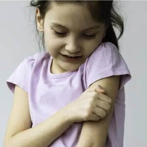 Alergia emocional Imagem de uma criança coçando o próprio braço, a coceira pode ser um dos sintomas de alergia emocional.