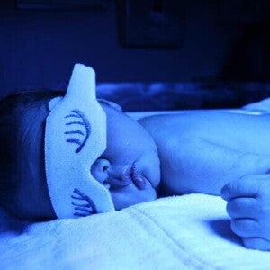 recém-nascido em fototerapia, deitado e com máscara branca decorada para proteger os olhos.