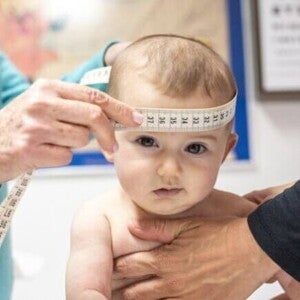 Bebê sendo examinado com uma fita métrica para medir o perímetro cefálico, acompanhamento médico essencial do crescimento infantil.